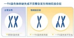 女子22年来从没来过例假 原来是少了1条X染色体 - News.Sina.com.Cn