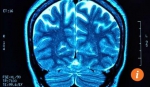 脑部扫描图 - News.Sina.com.Cn