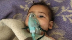 袭击后，一名叙利亚儿童在Maaret al-Noman镇接受治疗（图片来源：英国天空新闻网站） - News.Sina.com.Cn