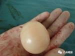 女婴带一块“玉”出生 医生：全世界极为罕见 - News.Sina.com.Cn