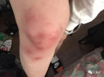被打留学生讲述，还有一名女留学生被踢膝盖、掐脖子（图片来自微信公众号“大堪村”） - News.Sina.com.Cn