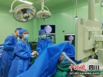 图为手术画面。成都市妇女儿童中心医院供图 - Sc.Chinanews.Com.Cn