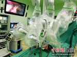 图为达芬奇手术机器人。成都市妇女儿童中心医院供图 - Sc.Chinanews.Com.Cn
